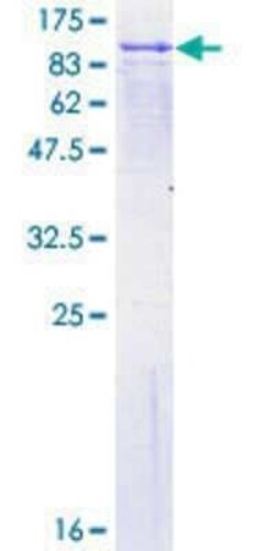 Novus Biologicals Recombinant Human FPGT GST (N-Term) Protein 25 &mu;g | Buy Online | Novus Biologicals&trade; | Fisher Scientific