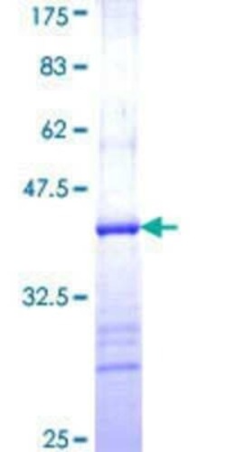 Novus Biologicals Recombinant Human FPGT GST (N-Term) Protein 10 &mu;g | Buy Online | Novus Biologicals&trade; | Fisher Scientific
