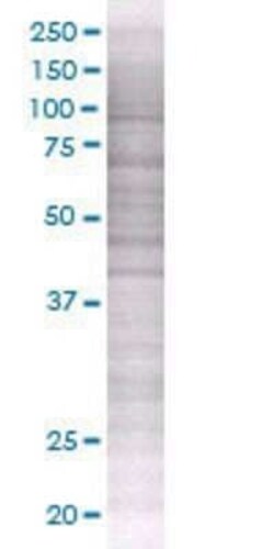 Novus Biologicals TRAILR3/TNFRSF10C 293T Cell Transient Overexpression Lysate 0.1 mL | Buy Online | Novus Biologicals&trade; | Fisher Scientific