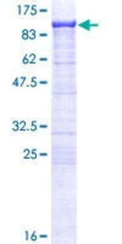 Novus Biologicals Recombinant Human SCEL GST (N-Term) Protein 25 &mu;g | Buy Online | Novus Biologicals&trade; | Fisher Scientific