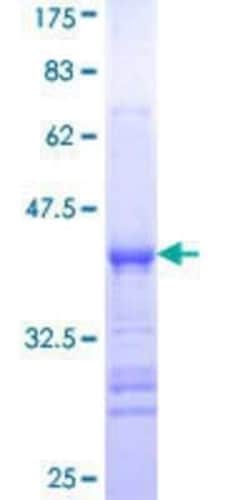 Novus Biologicals Recombinant Human DYRK4 GST (N-Term) Protein 25 &mu;g | Buy Online | Novus Biologicals&trade; | Fisher Scientific