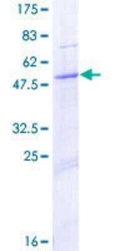 Novus Biologicals Recombinant Human PEX11B GST (N-Term) Protein 10 &mu;g | Buy Online | Novus Biologicals&trade; | Fisher Scientific