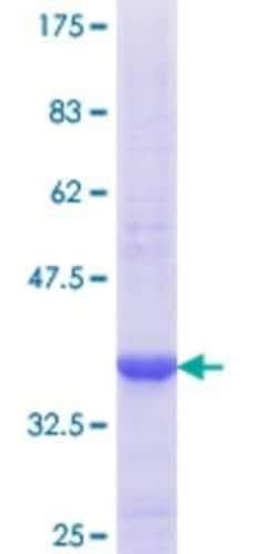 Novus Biologicals Recombinant Human PEX11B GST (N-Term) Protein 10 &mu;g | Buy Online | Novus Biologicals&trade; | Fisher Scientific