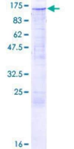 Novus Biologicals Recombinant Human TIF1 alpha GST (N-Term) Protein 25 &mu;g | Buy Online | Novus Biologicals&trade; | Fisher Scientific