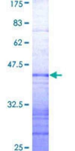 Novus Biologicals Recombinant Human TIF1 alpha GST (N-Term) Protein 10 &mu;g | Buy Online | Novus Biologicals&trade; | Fisher Scientific