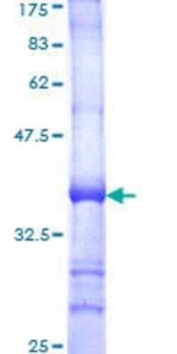 Novus Biologicals Recombinant Human IL18R1 GST (N-Term) Protein 2 &mu;g | Buy Online | Novus Biologicals&trade; | Fisher Scientific