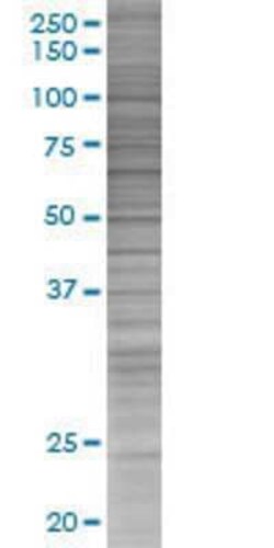 Novus Biologicals&trade;&nbsp;IL18R1 293T Cell Transient Overexpression Lysate