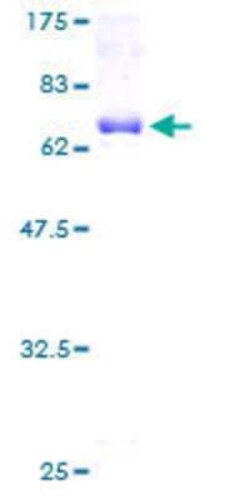 Novus Biologicals Recombinant Human CCNK GST (N-Term) Protein 10 &mu;g | Buy Online | Novus Biologicals&trade; | Fisher Scientific