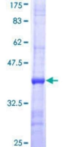 Novus Biologicals Recombinant Human DPM1 GST (N-Term) Protein 25 &mu;g | Buy Online | Novus Biologicals&trade; | Fisher Scientific