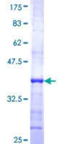 Novus Biologicals Recombinant Human CDKL1 GST (N-Term) Protein 10 &mu;g | Buy Online | Novus Biologicals&trade; | Fisher Scientific
