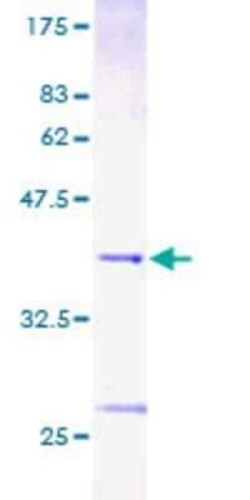 Novus Biologicals Recombinant Human BANF1 GST (N-Term) Protein 25 &mu;g | Buy Online | Novus Biologicals&trade; | Fisher Scientific
