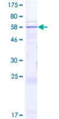 Novus Biologicals Recombinant Human DCAF5 GST (N-Term) Protein 2 &mu;g | Buy Online | Novus Biologicals&trade; | Fisher Scientific