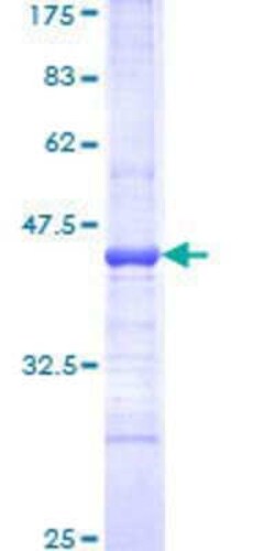 Novus Biologicals Recombinant Human SAP30 GST (N-Term) Protein 10 &mu;g | Buy Online | Novus Biologicals&trade; | Fisher Scientific