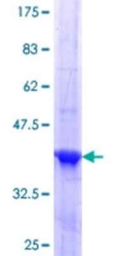 Novus Biologicals Recombinant Human HESX1 GST (N-Term) Protein 10 &mu;g | Buy Online | Novus Biologicals&trade; | Fisher Scientific