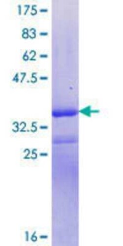 Novus Biologicals Recombinant Human SynGAP GST (N-Term) Protein 10 &mu;g | Buy Online | Novus Biologicals&trade; | Fisher Scientific
