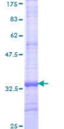 Novus Biologicals Recombinant Human TMEM11 GST (N-Term) Protein 10 &mu;g | Buy Online | Novus Biologicals&trade; | Fisher Scientific