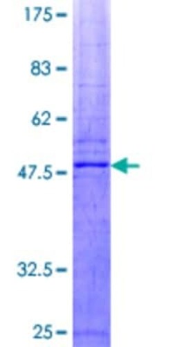 Novus Biologicals Recombinant Human SOCS-2 GST (N-Term) Protein 2 &mu;g | Buy Online | Novus Biologicals&trade; | Fisher Scientific