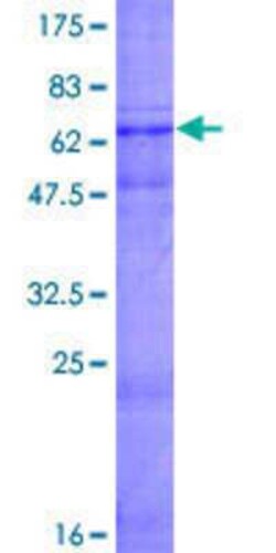 Novus Biologicals Recombinant Human WISP3 GST (N-Term) Protein 2 &mu;g | Buy Online | Novus Biologicals&trade; | Fisher Scientific