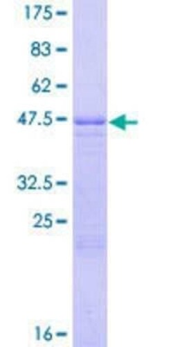 Novus Biologicals Recombinant Human WISP2 GST (N-Term) Protein 10 &mu;g | Buy Online | Novus Biologicals&trade; | Fisher Scientific