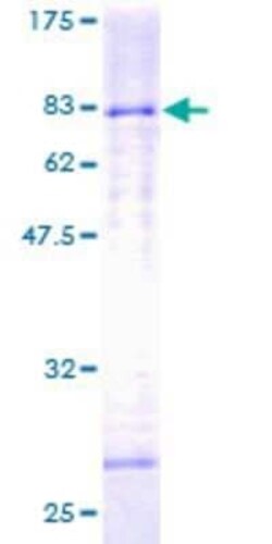 Novus Biologicals Recombinant Human HDAC3 GST (N-Term) Protein 25 &mu;g | Buy Online | Novus Biologicals&trade; | Fisher Scientific
