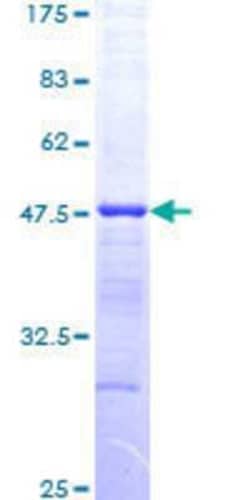 Novus Biologicals Recombinant Human HDAC3 GST (N-Term) Protein 25 &mu;g | Buy Online | Novus Biologicals&trade; | Fisher Scientific