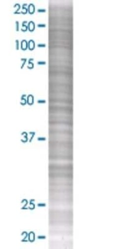 Novus Biologicals GPR109B/HM74 293T Cell Transient Overexpression Lysate 0.1 mL | Buy Online | Novus Biologicals&trade; | Fisher Scientific