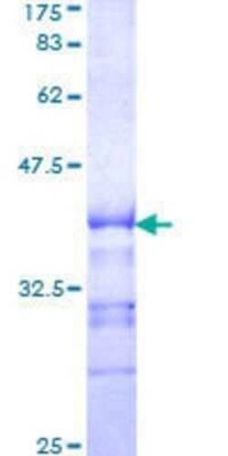 Novus Biologicals Recombinant Human KSR1 GST (N-Term) Protein 10 &mu;g | Buy Online | Novus Biologicals&trade; | Fisher Scientific