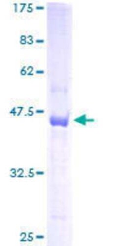 Novus Biologicals Recombinant Human TSC22/TSC22D1 GST (N-Term) Protein 25 &mu;g | Buy Online | Novus Biologicals&trade; | Fisher Scientific