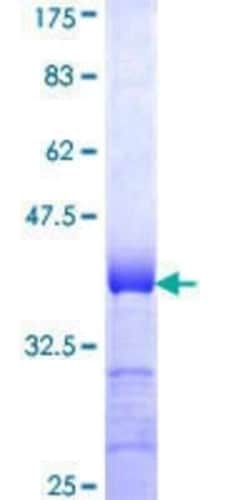 Novus Biologicals Recombinant Human PAG3 GST (N-Term) Protein 25 &mu;g | Buy Online | Novus Biologicals&trade; | Fisher Scientific