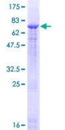 Novus Biologicals Recombinant Human Protein Z GST (N-Term) Protein 10 &mu;g | Buy Online | Novus Biologicals&trade; | Fisher Scientific