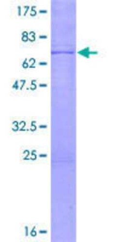 Novus Biologicals Recombinant Human STK19 GST (N-Term) Protein 2 &mu;g | Buy Online | Novus Biologicals&trade; | Fisher Scientific
