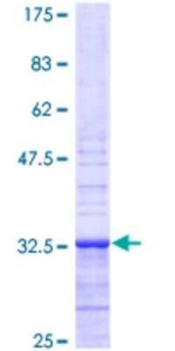Novus Biologicals Recombinant Human Apelin GST (N-Term) Protein 2 &mu;g | Buy Online | Novus Biologicals&trade; | Fisher Scientific