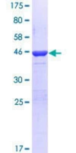 Novus Biologicals&trade;&nbsp;Recombinant Human PER2 GST (N-Term) Protein