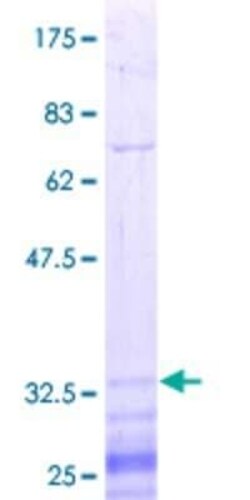 Novus Biologicals Recombinant Human ARHGEF7 GST (N-Term) Protein 25 &mu;g | Buy Online | Novus Biologicals&trade; | Fisher Scientific