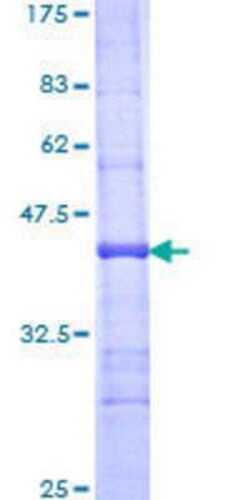 Novus Biologicals Recombinant Human SGPL1 GST (N-Term) Protein 25 &mu;g | Buy Online | Novus Biologicals&trade; | Fisher Scientific