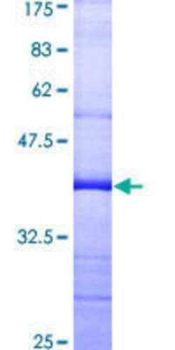 Novus Biologicals Recombinant Human CDC16 GST (N-Term) Protein 10 &mu;g | Buy Online | Novus Biologicals&trade; | Fisher Scientific