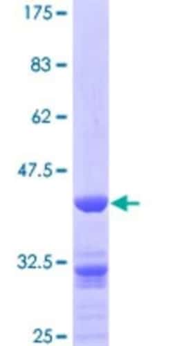 Novus Biologicals Recombinant Human ZNF259 GST (N-Term) Protein 25 &mu;g | Buy Online | Novus Biologicals&trade; | Fisher Scientific