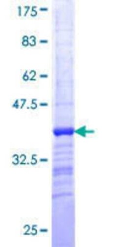 Novus Biologicals Recombinant Human ZNF259 GST (N-Term) Protein 25 &mu;g | Buy Online | Novus Biologicals&trade; | Fisher Scientific