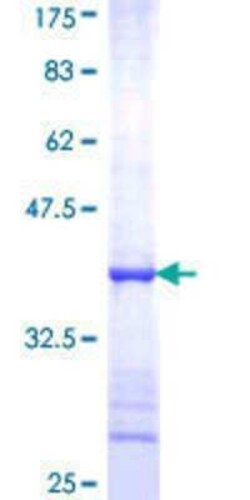 Novus Biologicals Recombinant Human DDX18 GST (N-Term) Protein 2 &mu;g | Buy Online | Novus Biologicals&trade; | Fisher Scientific
