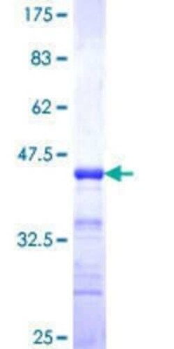 Novus Biologicals Recombinant Human TAX1BP1 GST (N-Term) Protein 25 &mu;g | Buy Online | Novus Biologicals&trade; | Fisher Scientific