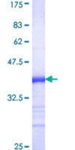 Novus Biologicals Recombinant Human MCM3AP GST (N-Term) Protein 10 &mu;g | Buy Online | Novus Biologicals&trade; | Fisher Scientific