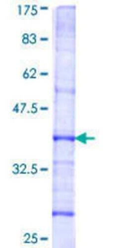 Novus Biologicals Recombinant Human eIF2B4 GST (N-Term) Protein 10 &mu;g | Buy Online | Novus Biologicals&trade; | Fisher Scientific