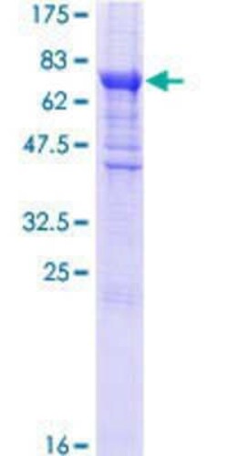 Novus Biologicals Recombinant Human eIF2B3 GST (N-Term) Protein 25 &mu;g | Buy Online | Novus Biologicals&trade; | Fisher Scientific