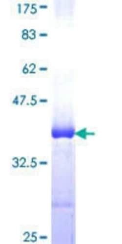 Novus Biologicals Recombinant Human eIF2B epsilon GST (N-Term) Protein 10 &mu;g | Buy Online | Novus Biologicals&trade; | Fisher Scientific