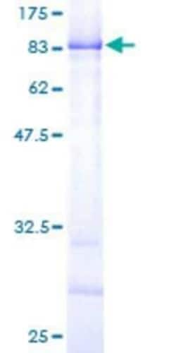 Novus Biologicals Recombinant Human CPNE3 GST (N-Term) Protein 25 &mu;g | Buy Online | Novus Biologicals&trade; | Fisher Scientific