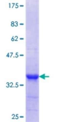 Novus Biologicals Recombinant Human CPNE3 GST (N-Term) Protein 25 &mu;g | Buy Online | Novus Biologicals&trade; | Fisher Scientific