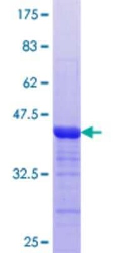 Novus Biologicals&trade;&nbsp;Recombinant Human MTMR3 GST (N-Term) Protein