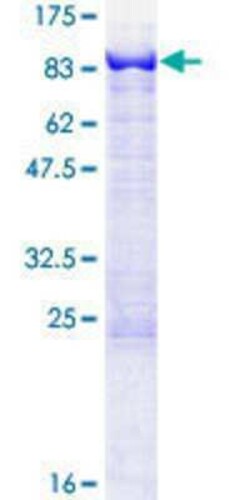 Novus Biologicals Recombinant Human MTMR2 GST (N-Term) Protein 25 &mu;g | Buy Online | Novus Biologicals&trade; | Fisher Scientific