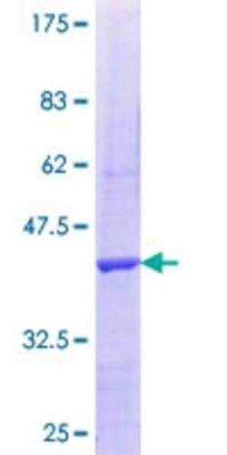 Novus Biologicals Recombinant Human PRPF4B GST (N-Term) Protein 25 &mu;g | Buy Online | Novus Biologicals&trade; | Fisher Scientific