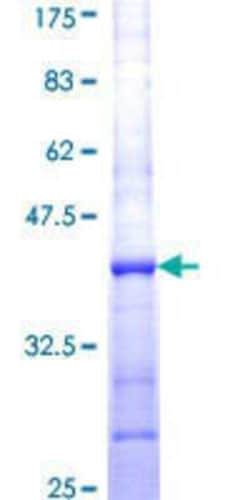 Novus Biologicals Recombinant Human CPNE1 GST (N-Term) Protein 25 &mu;g | Buy Online | Novus Biologicals&trade; | Fisher Scientific
